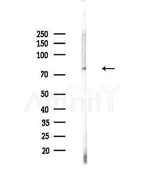 PHACTR4 Antibody - Western blot analysis of lysates from LoVo cells(heat-shock,45min treatment), using PHACTR4 Antibody at 1/1000 dilution.