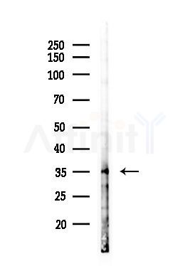 PITPNB Antibody - Western blot analysis of lysates from Hela cells(heat-shock,45min treatment), using PITPNB Antibody at 1/1000 dilution.