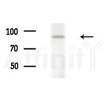 PIP5K1C Antibody - Western blot analysis of lysates from B16F10-LUC cells(starvation,24h treatment), using PIP5K1C Antibody at 1/1000 dilution.