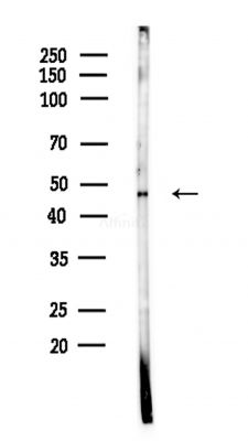 KCNK4 Antibody - Western blot analysis of lysates from Hela cells(heat-shock,45min treatment), using KCNK4 Antibody at 1/1000 dilution.