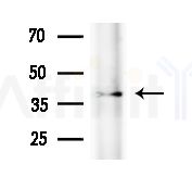KCNK6 Antibody - Western blot analysis of extracts from B16F10-LUC cells
(heat-shock treatment), using KCNK6 Antibody at 1/1000 dilution.