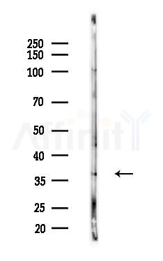 KCNK6 Antibody - Western blot analysis of lysates from B16F10-LUC cells(heat-shock,45min treatment), using KCNK6 Antibody at 1/1000 dilution.