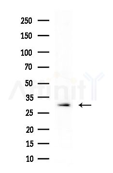 KCNK7 Antibody - Western blot analysis of extracts from HepG2 cells
(heat-shock treatment), using KCNK7 Antibody at 1/1000 dilution.