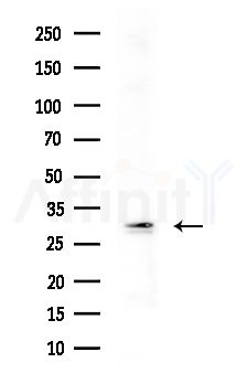 KCNK7 Antibody - Western blot analysis of extracts from B16F10-LUC cells
(heat-shock treatment), using KCNK7 Antibody at 1/1000 dilution.