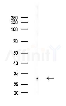 KCNK7 Antibody - Western blot analysis of lysates from B16F10-LUC cells(heat-shock,45min treatment), using KCNK7 Antibody at 1/1000 dilution.