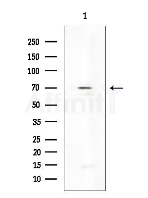 KCNA5 Antibody - Western blot analysis of extracts from Rat brain, using KCNA5 Antibody at 1/1000 dilution.