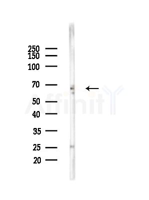 KCNA5 Antibody - Western blot analysis of lysates from Rat brain, using KCNA5 Antibody at 1/1000 dilution.