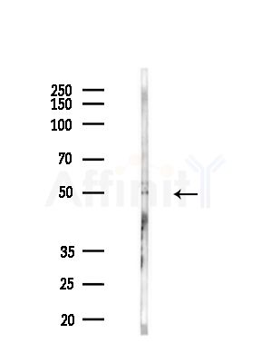 KCNC1 Antibody - Western blot analysis of lysates from B16(LPS, 4h treatment), using KCNC1 Antibody at 1/1000 dilution.
