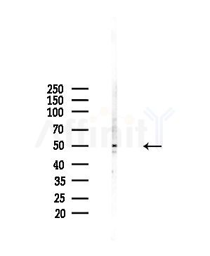 KCNF1 Antibody - Western blot analysis of lysates from A375 cells(starvation,24h treatment), using KCNF1 Antibody at 1/1000 dilution.