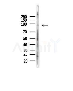 KCNQ5 Antibody - Western blot analysis of lysates from COLO205 cells(heat-shock,45min treatment), using KCNQ5 Antibody at 1/1000 dilution.