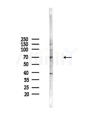 CDC40 Antibody - Western blot analysis of lysates from A375 cells(starvation,24h treatment), using CDC40 Antibody at 1/1000 dilution.