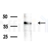 PRPF18 Antibody - Western blot analysis of extracts from HepG2 cells(LPS 4h treatment), using PRPF18 Antibody at 1/1000 dilution.