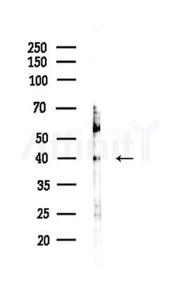 PRPF18 Antibody - Western blot analysis of lysates from HepG2 cells(LPS 4h treatment), using PRPF18 Antibody at 1/1000 dilution.