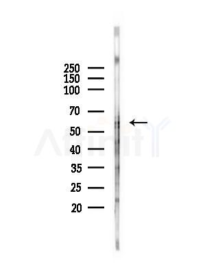PSAP Antibody - Western blot analysis of lysates from Hela cells(heat-shock,45min treatment), using PSAP Antibody at 1/1000 dilution.
