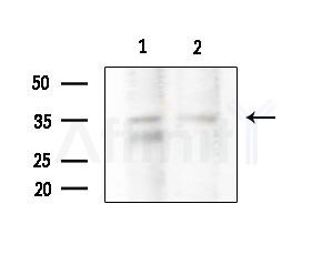 ZDHHC20 Antibody - Western blot analysis of extracts from various samples, using ZDHHC20 Antibody at 1/1000 dilution.