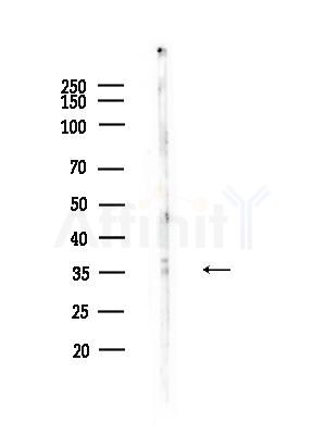 ZDHHC20 Antibody - Western blot analysis of lysates from HUVEC cells, using ZDHHC20 Antibody at 1/1000 dilution.