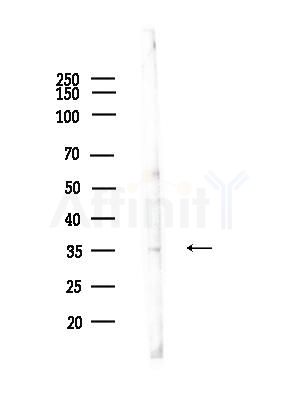 ZDHHC20 Antibody - Western blot analysis of lysates from Rat testis, using ZDHHC20 Antibody at 1/1000 dilution.