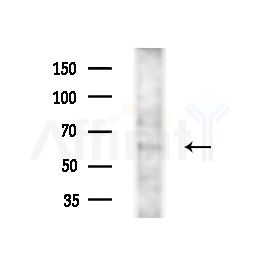 FNTB Antibody - Western blot analysis of lysates from B16F10-LUC cells(starvation,24h treatment), using FNTB Antibody at 1/1000 dilution.