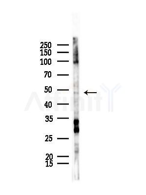 FNTB Antibody - Western blot analysis of lysates from B16F10-LUC cells(starvation,24h treatment), using FNTB Antibody at 1/1000 dilution.