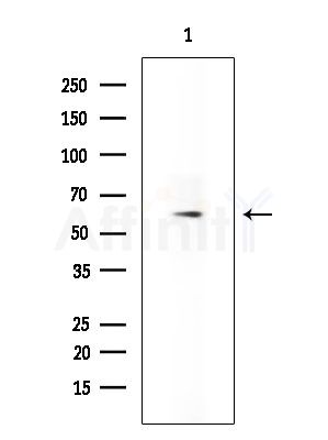 PPP1R16B Antibody - Western blot analysis of extracts from A375 cells(starvation treatment), using PPP1R16B Antibody at 1/1000 dilution.