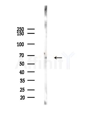PPP1R16B Antibody - Western blot analysis of lysates from A375 cells(starvation,24h treatment), using PPP1R16B Antibody at 1/1000 dilution.