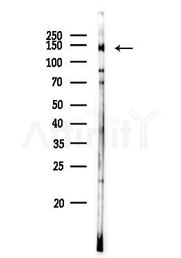 PPP1R3A Antibody - Western blot analysis of lysates from Rat liver, using PPP1R3A Antibody at 1/1000 dilution.