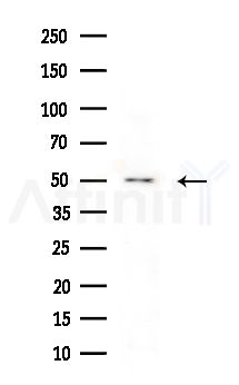 PPM1L Antibody - Western blot analysis of extracts from HepG2 cells
(heat-shock treatment), using PPM1L Antibody at 1/1000 dilution.