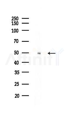 PPM1L Antibody - Western blot analysis of lysates from HepG2 cells(heat-shock,45min treatment), using PPM1L Antibody at 1/1000 dilution.