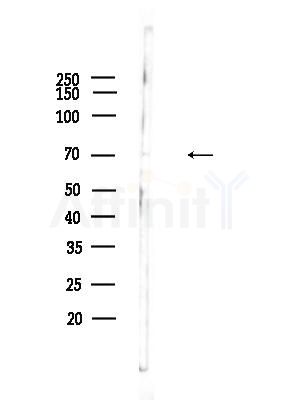 RED Antibody - Western blot analysis of lysates from HepG2 cells(heat-shock,45min treatment), using RED Antibody at 1/1000 dilution.