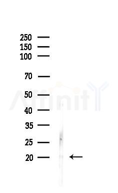 S100A16 Antibody - Western blot analysis of lysates from Rat liver, using S100A16 Antibody at 1/1000 dilution.