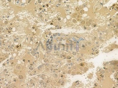 S100A16 Antibody - DF4353 at 1/100 staining human normal lung tissue by IHC-P.