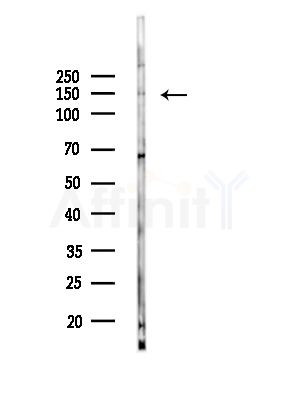 MOV10L1 Antibody - Western blot analysis of lysates from A375 cells(LPS, 4h treatment), using MOV10L1 Antibody at 1/1000 dilution.