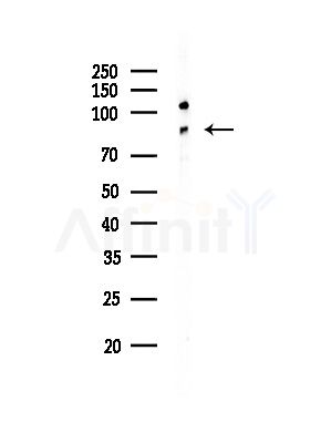 PDXDC1 Antibody - Western blot analysis of lysates from Hela cells(starvation,24h treatment), using PDXDC1 Antibody at 1/1000 dilution.