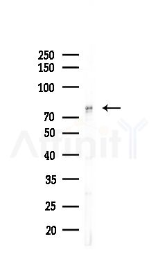 CHML Antibody - Western blot analysis of lysates from Hela cells(heat-shock,45min treatment), using CHML Antibody at 1/1000 dilution.