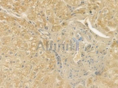 RAB3GAP1 Antibody - DF4371 at 1/100 staining human normal liver tissue by IHC-P.