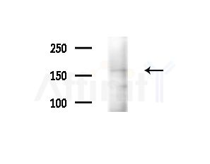 RAB3GAP2 Antibody - Western blot analysis of extracts from Rat brain, using RAB3GAP2 Antibody at 1/1000 dilution.