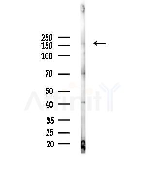 RAB3GAP2 Antibody - Western blot analysis of lysates from Rat brain, using RAB3GAP2 Antibody at 1/1000 dilution.
