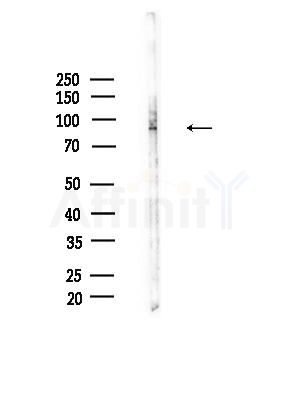 ZFYVE20 Antibody - Western blot analysis of lysates from Rat testis, using ZFYVE20 Antibody at 1/1000 dilution.