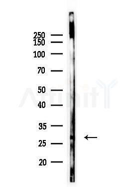 RABL2A Antibody - Western blot analysis of lysates from EC304 cells(heat-shock,45min treatment), using RABL2A Antibody at 1/1000 dilution.