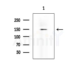 RANBP6 Antibody - Western blot analysis of extracts from EC304 cells, using RANBP6 Antibody at 1/1000 dilution.