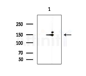 RANBP6 Antibody - Western blot analysis of extracts from A375 cells(starvation treatment), using RANBP6 Antibody at 1/1000 dilution.