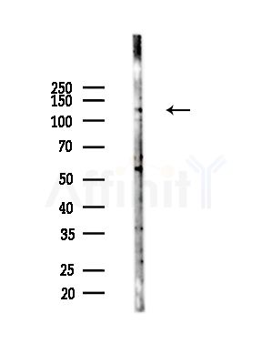 RANBP6 Antibody - Western blot analysis of lysates from A375 cells(starvation,24h treatment), using RANBP6 Antibody at 1/1000 dilution.