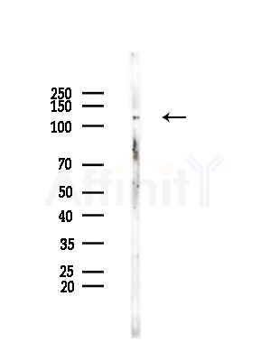 RANBP6 Antibody - Western blot analysis of lysates from EC304 cells, using RANBP6 Antibody at 1/1000 dilution.