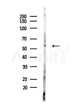 G3BP2 Antibody - Western blot analysis of lysates from LOV0(heat-shock,45min treatment), using G3BP2 Antibody at 1/1000 dilution.