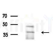 RRAGA/B Antibody - Western blot analysis of lysates from HepG2 cells(LPS 4h treatment), using RRAGA/B Antibody at 1/1000 dilution.