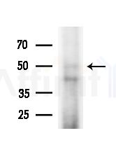 RRAGB Antibody - Western blot analysis of extracts from Hela cells(heat-shock,45min treatment), using RRAGB Antibody at 1/1000 dilution.