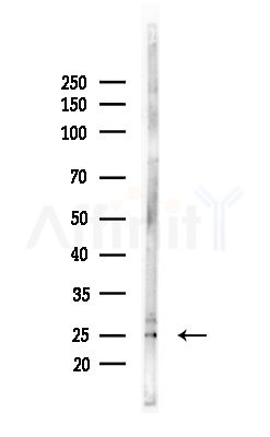 RAB20 Antibody - Western blot analysis of lysates from Mouse brain, using RAB20 Antibody at 1/1000 dilution.