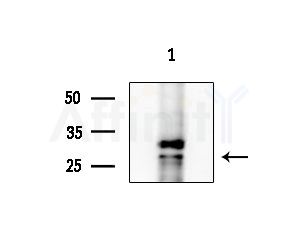 RAB20 Antibody - Western blot analysis of extracts from HepG2 cells(LPS 4h treatment), using RAB20 Antibody at 1/1000 dilution.