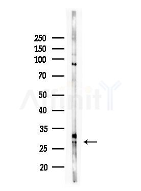 RAB20 Antibody - Western blot analysis of lysates from HepG2 cells(LPS,4h treatment), using RAB20 Antibody at 1/1000 dilution.