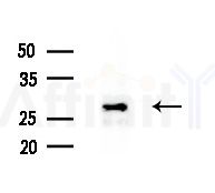 RAB26 Antibody - Western blot analysis of extracts from HepG2 cells(LPS 4h treatment), using RAB26 Antibody at 1/1000 dilution.